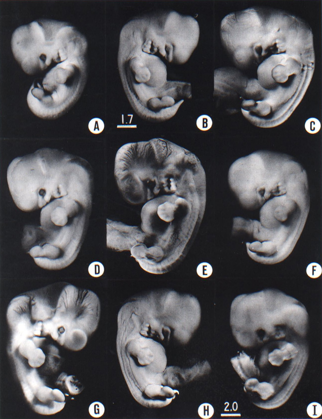 human embryo development day by day