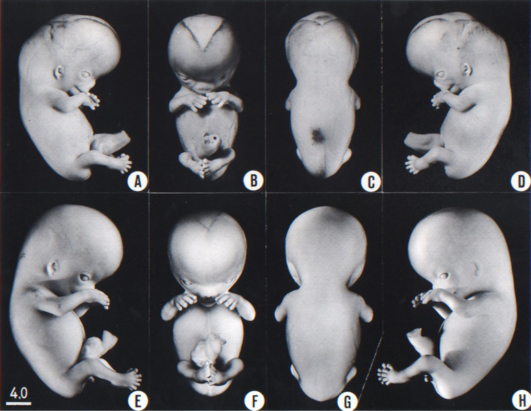 elephant embryo vs human embryo