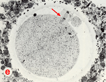 High power LM of section through the fertilization cone