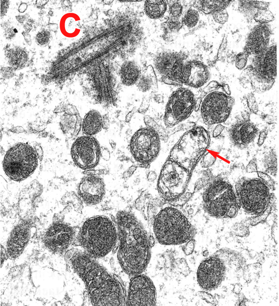 Carnegie Stage 1-33 – Detail of sperm mitochondria