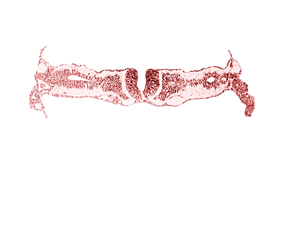 dorsal aorta, midgut, nephrogenic cord, neural fold [rhombencephalon (Rh. D)], primordial peritoneal cavity, right umbilical vein, somitocoel 2