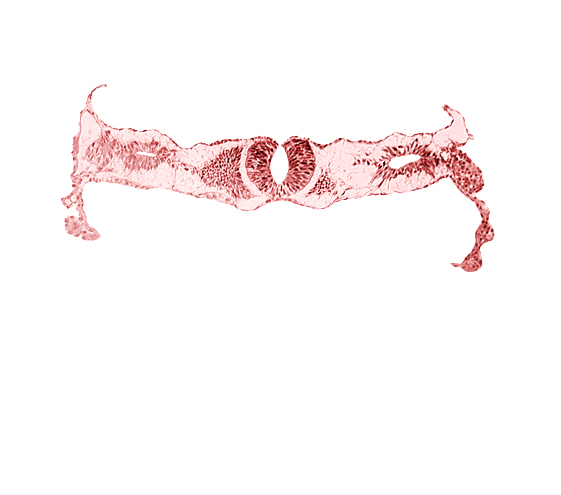 amnion, junction area of neural folds [rhombencephalon (Rh. D)], midgut, notochordal plate, primordial peritoneal cavity, somite 2-3 intersegmental region