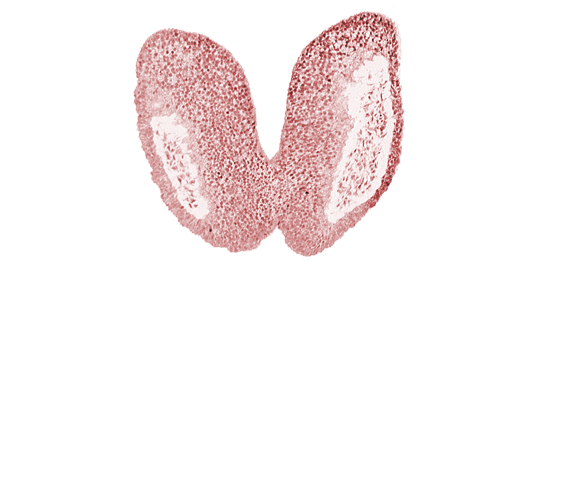 artifact space(s), chiasmatic plate (D1), head mesenchyme, junction of neural fold and surface ectoderm, neural fold [primordial diencephalon (D2)], neural fold [primordial telencephalon medium (T)], neural groove, optic nerve primordium (CN II) [primordial diencephalon (D1)], optic sulcus [primordial diencephalon (D1)], surface ectoderm of head, terminal notch