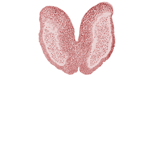 amniotic cavity, artifact space(s), cephalic neuropore, chiasmatic plate (D1), head mesenchyme, junction of neural fold and surface ectoderm, maxillary prominence of pharyngeal arch 1, neural fold [primordial diencephalon (D2)], neural fold [primordial telencephalon medium (T)], neural groove, surface ectoderm of head, terminal notch