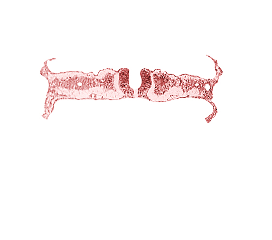 amnion attachment, amniotic cavity, caudal neuropore, dorsal aorta, extra-embryonic coelom, midgut, nephrogenic cord, right umbilical vein, somite 6 (C-2), somitocoel 6, umbilical vesicle cavity, umbilical vesicle wall