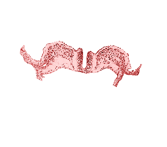 caudal neuropore, dorsal aorta plexus, midgut, primordial lateral body fold, surface ectoderm