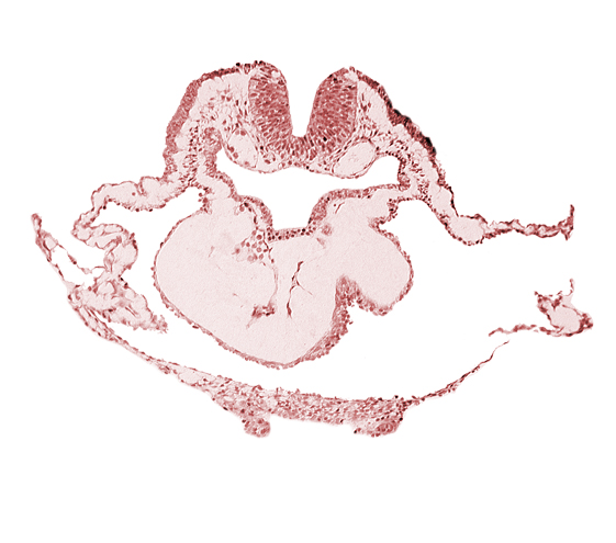 artifact separation(s), bulbis cordis, dorsal aorta, lateral pharyngeal recess, left bulboventricular sulcus, neural fold [rhombencephalon (Rh. B)], notochordal plate, pericardial cavity, presumptive right ventricle