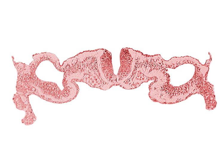 alar plate(s), basal plate, dorsal aorta, dorsal intersegmental artery, midgut, primordial peritoneal cavity, sulcus limitans, umbilical vesicle wall