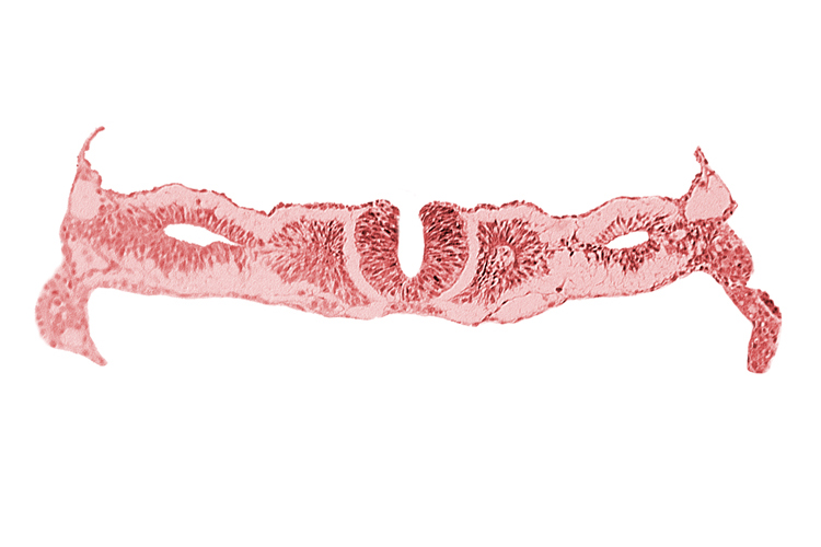 cephalic neuropore, dorsal aorta, nephrogenic cord, neural fold [rhombencephalon (Rh. D)], primordial peritoneal cavity, right umbilical vein, somite 2 (O-2), somitocoel 2