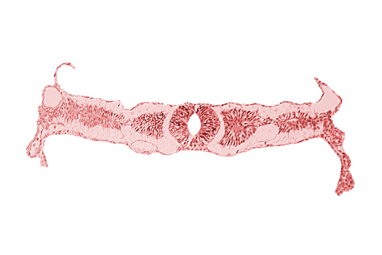amnion attachment, dorsal aorta, midgut, somite 3 (O-3), umbilical vesicle wall