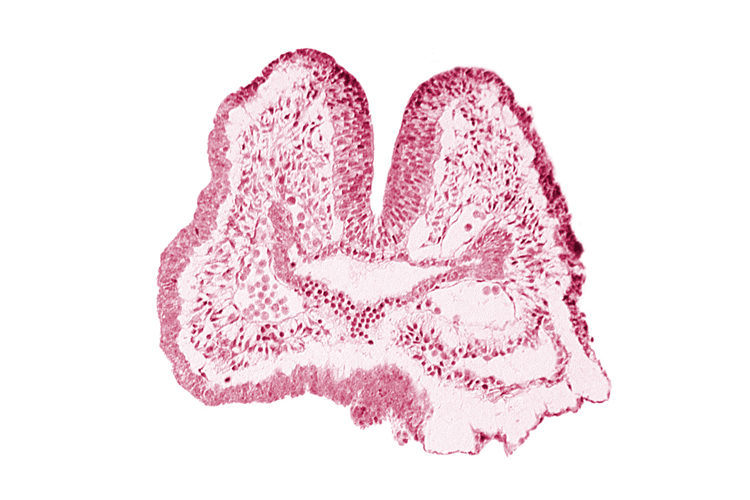 aortic arch 1, cephalic neuropore, dorsal aorta, endoderm, facio-vestibulocochlear neural crest (CN VII and CN VIII), floor of foregut, foregut, neural fold [rhombencephalon (Rh. A)], notochordal plate, pericardial cavity, pharyngeal pouch 1, surface ectoderm