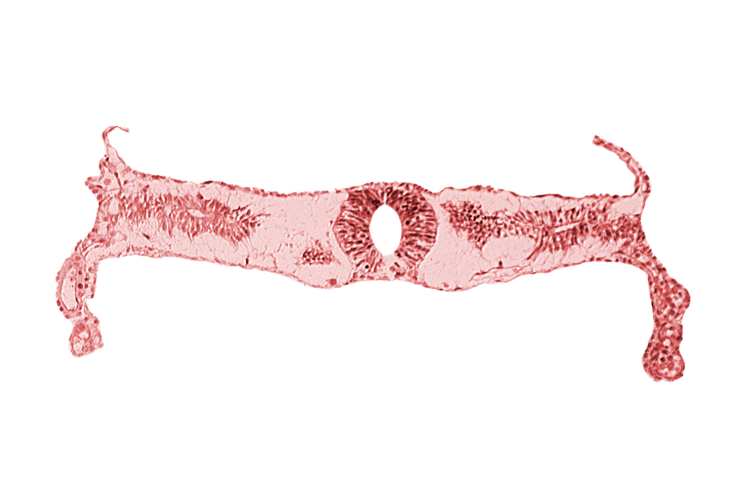 extra-embryonic coelom, midgut, neural tube [rhombencephalon (Rh. D)], somite 3-4 intersegmental region