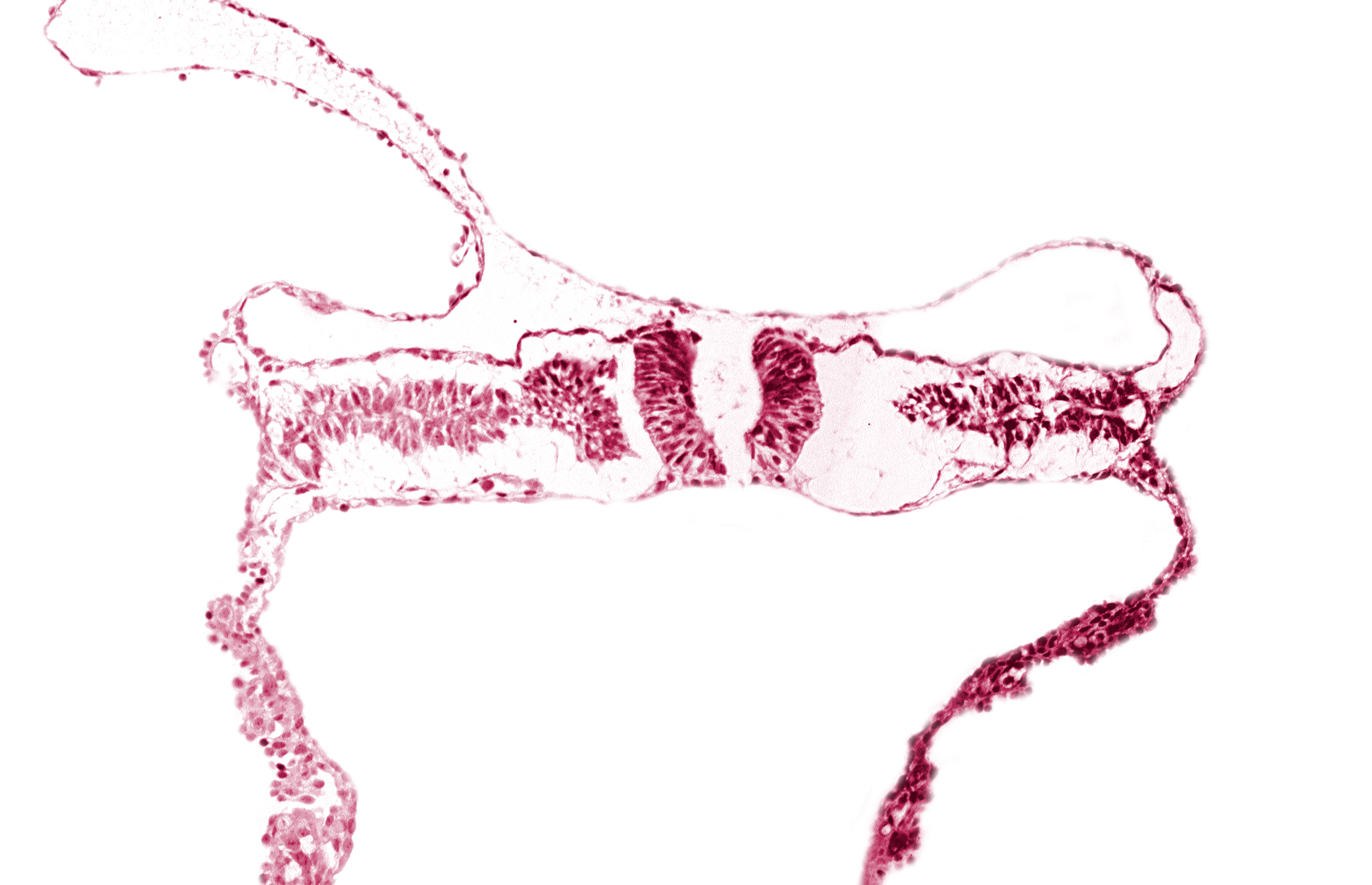 caudal neuropore, somite 5-6 intersegmental region