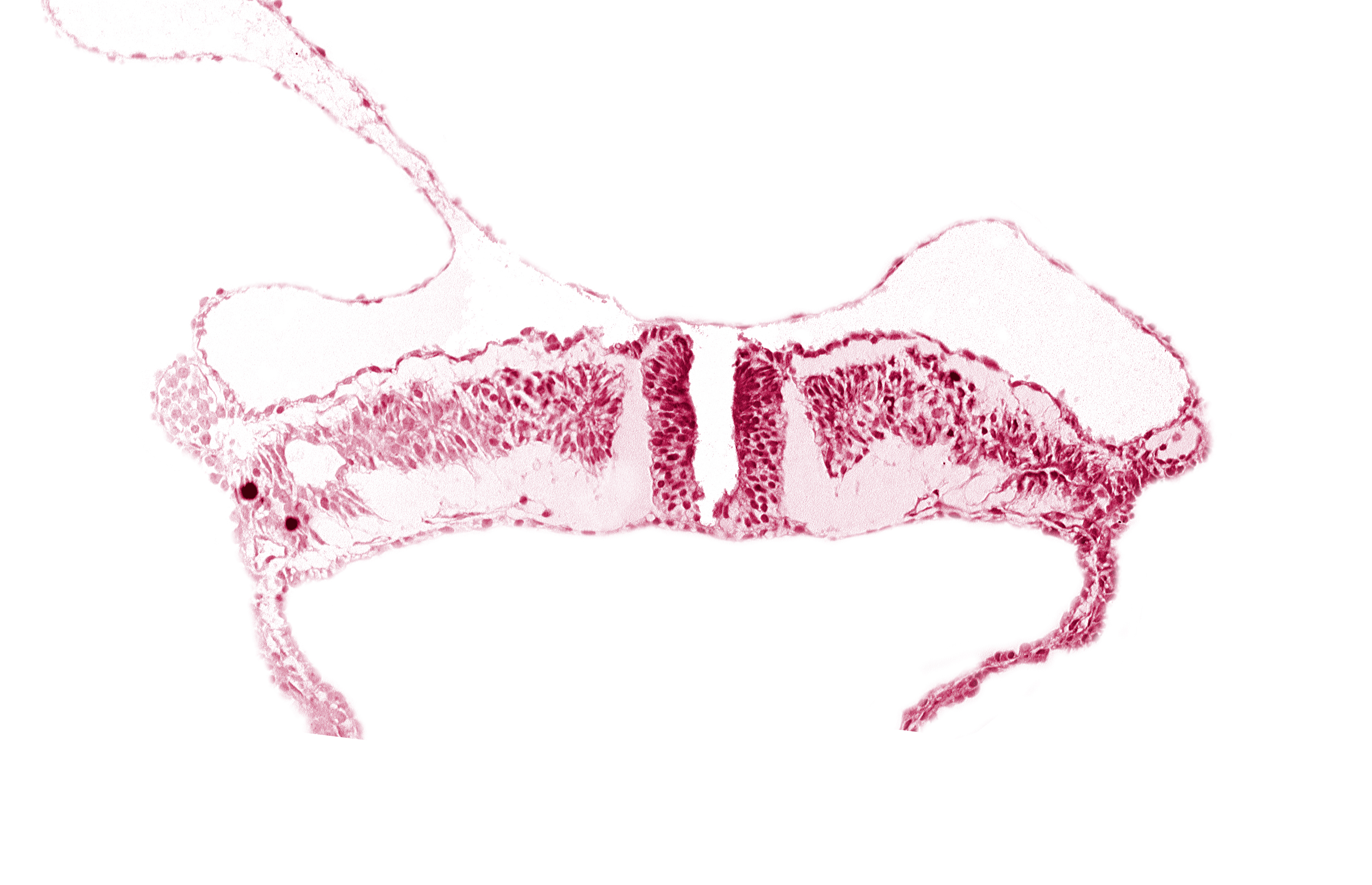 caudal neuropore, dorsal aorta, lateral plate mesoderm, paraxial mesoderm