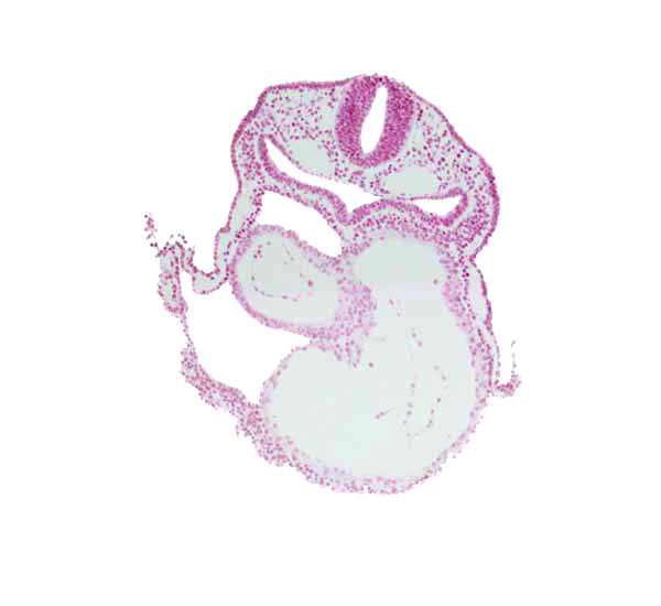 amnion attachment, cephalic part of atrioventricular canal, dorsal aorta, glossopharyngeal neural crest (CN IX), lateral pharyngeal recess, left ventricle, pericardial cavity, precardinal vein, respiratory primordium, rhombencephalon (Rh. 6), right atrium
