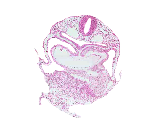 caudal part of left ventricle, dorsal aorta, interatrial foramen (primum), left atrium, precardinal vein, right atrium, umbilical vesicle wall