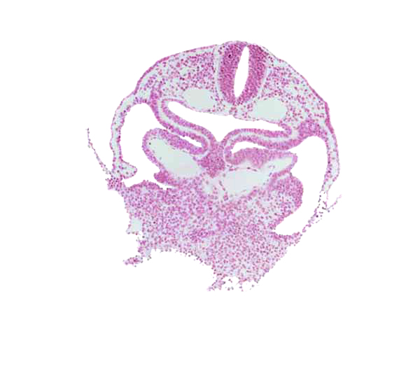 amnion attachment, cephalic edge of dermatomyotome 1 (O-1), course of common cardinal vein, hepatic plate, hypoglossal neural crest (CN XII), left horn of sinus venosus, pericardial cavity, precardinal vein, rhombencephalon (Rh. D), right horn of sinus venosus, septum transversum, umbilical vesicle wall