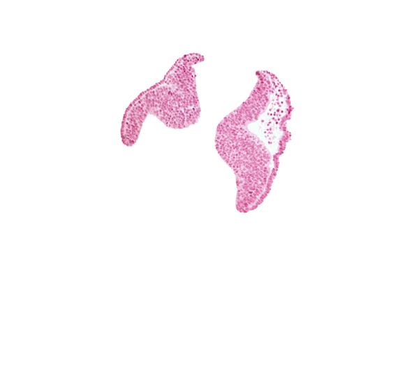 cephalic neuropore, junction of neural ectoderm and surface ectoderm, neural fold [diencephalon (D1)], neural fold [diencephalon (D2)], neural fold [mesencephalon (M)], optic nerve primordium (CN II) [diencephalon (D1)], optic sulcus