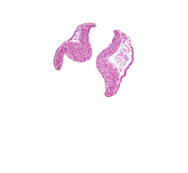 artifact space(s), cephalic neuropore, neural fold [diencephalon (D1)], neural fold [diencephalon (D2)], neural fold [mesencephalon (M)], optic nerve primordium (CN II) [diencephalon (D1)], optic sulcus