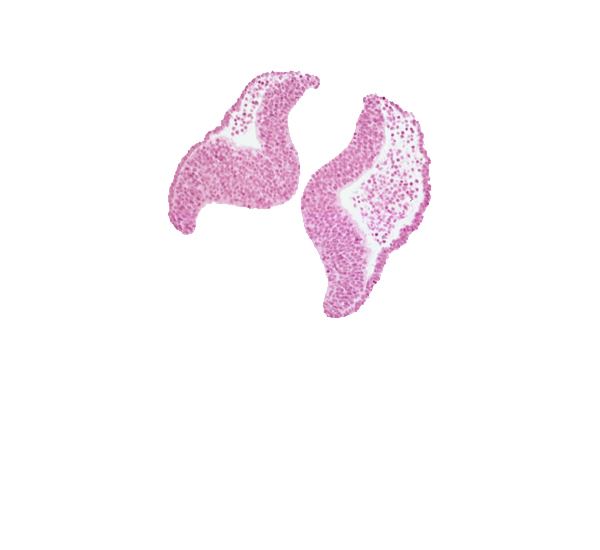 artifact space(s), head mesenchyme, neural fold [diencephalon (D1)], neural fold [diencephalon (D2)], neural fold [mesencephalon (M)], optic sulcus