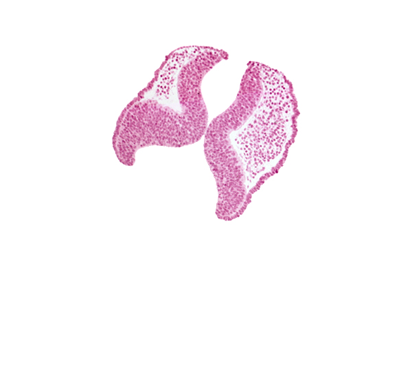 cephalic neuropore, head mesenchyme, junction of neural ectoderm and surface ectoderm, neural fold [diencephalon (D1)], neural fold [diencephalon (D2)], neural fold [mesencephalon (M)], optic nerve primordium (CN II) [diencephalon (D1)], optic sulcus