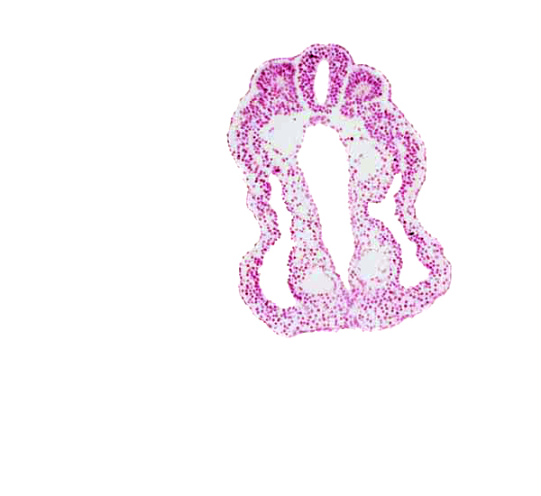 hindgut, left umbilical artery, notochord, right umbilical artery, somite 13 (T-1), somitocoel 13, spinal part of neural tube