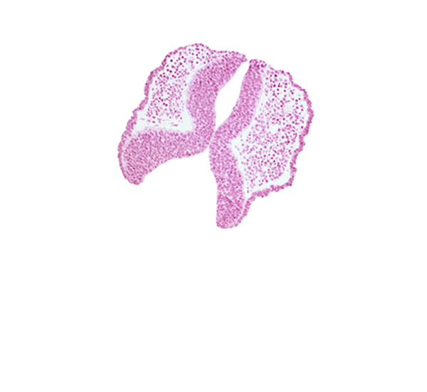 caudal edge of cephalic neuropore, internal carotid artery, neural fold [diencephalon (D1)], neural fold [diencephalon (D2)], neural fold [mesencephalon (M)], neural groove, optic nerve primordium (CN II) [diencephalon (D1)], primordial blood vessel(s)