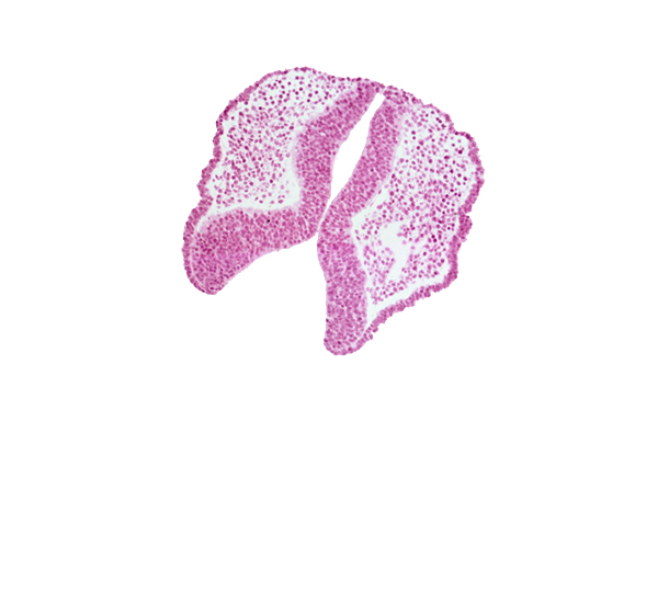 cephalic part of dorsal aorta, fused neural folds, internal carotid artery, junction of neural ectoderm and surface ectoderm, neural fold [diencephalon (D1)], neural fold [diencephalon (D2)], neural fold [mesencephalon (M)], neural groove, rhombencephalon (Rh. 1)