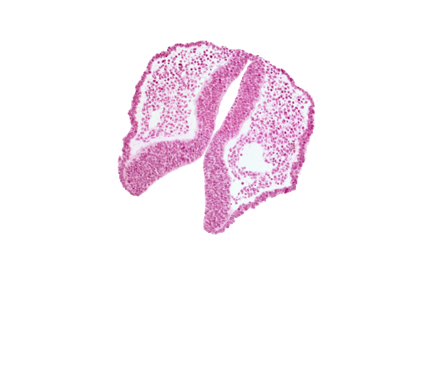 artifact space(s), dorsal aorta, neural fold [diencephalon (D1)], neural fold [diencephalon (D2)], neural fold [mesencephalon (M)], neural groove, rhombencephalon (Rh. 1)
