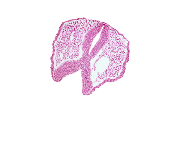artifact space(s), chiasmatic plate (D1), dorsal aorta, floor plate of neural folds [diencephalon (D2)], head mesenchyme, neural fold [diencephalon (D1)], neural fold [mesencephalon (M)], rhombencephalon (Rh. 1), surface ectoderm