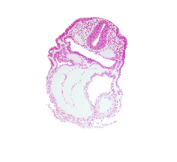 aortic sac, cardiac jelly, cephalic edge of left ventricle, conotruncus, dorsal aorta, epimyocardium, foregut lumen, otic placode, pericardial cavity, right ventricle