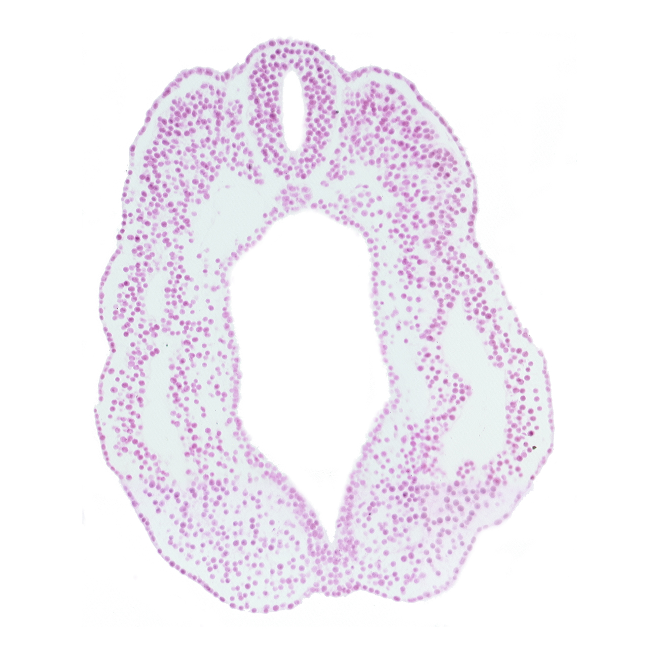 cloacal membrane, cloacal part of hindgut, dorsal aorta, dorsal aorta plexus, endoderm, peritoneal cavity (coelom), spinal part of neural tube, surface ectoderm