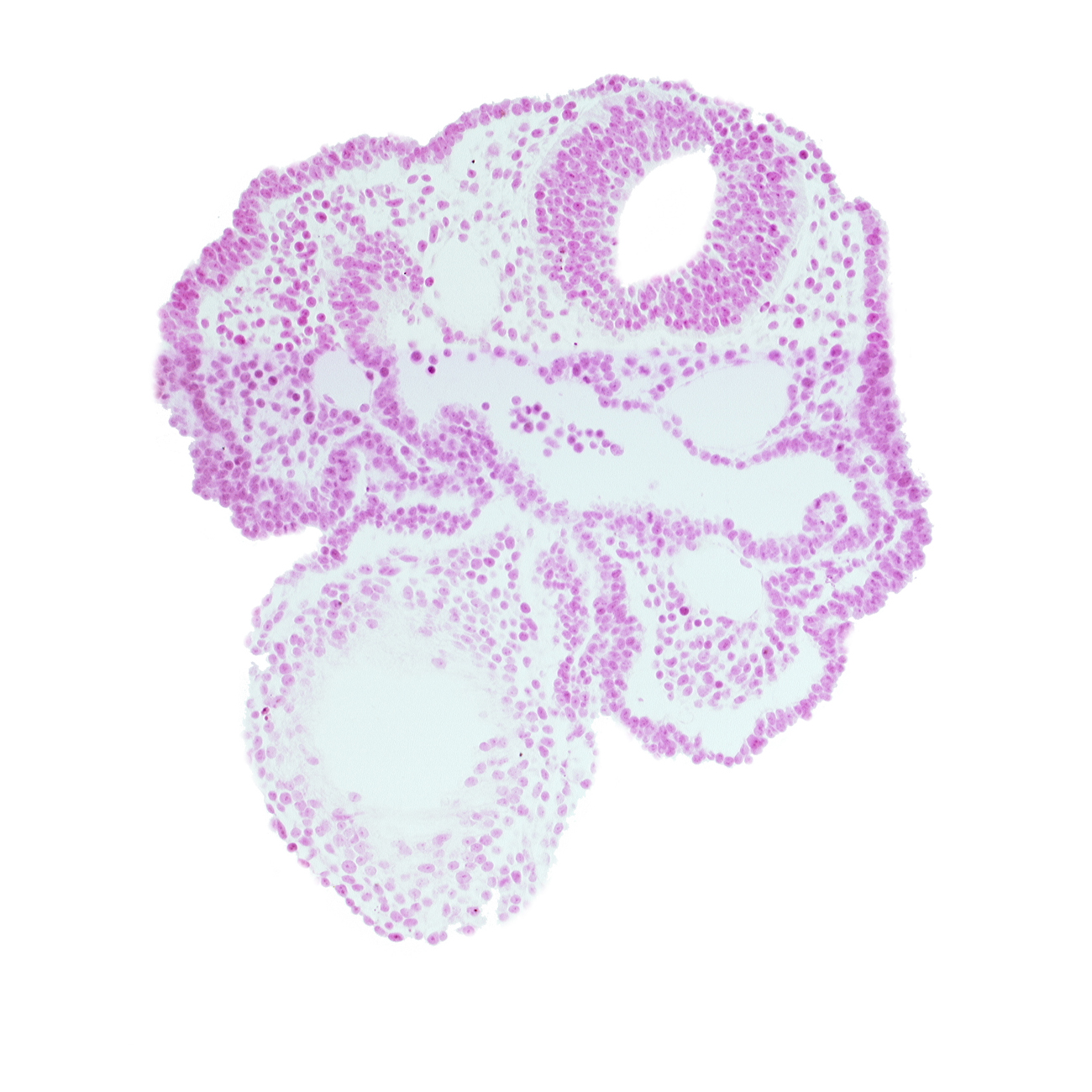 cardiac jelly, dorsal aorta, ectodermal ring, epimyocardium, mandibular prominence of pharyngeal arch 1, notochord, rhombencephalon (Rh. 3), surface ectoderm