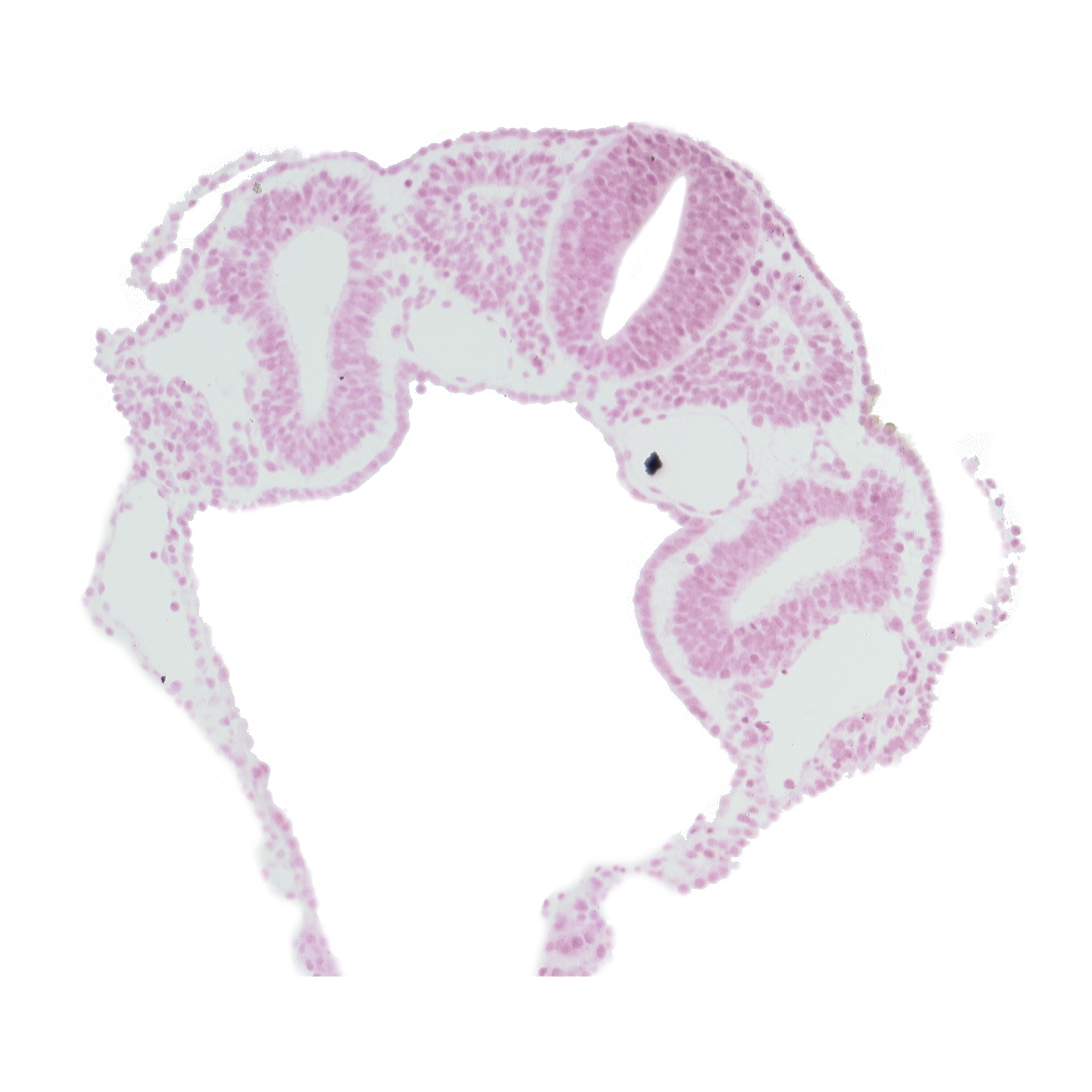 dermatomyotome 3 (O-3) , hypoglossal neural crest (CN XII), junction of left horn of sinus venosus and left vitelline (omphalomesenteric) vein, left horn of sinus venosus, midgut, peritoneal cavity (coelom), postcardinal vein, rhombencephalon (Rh. D), right horn of sinus venosus, right vitelline (omphalomesenteric) vein, somitocoel 3