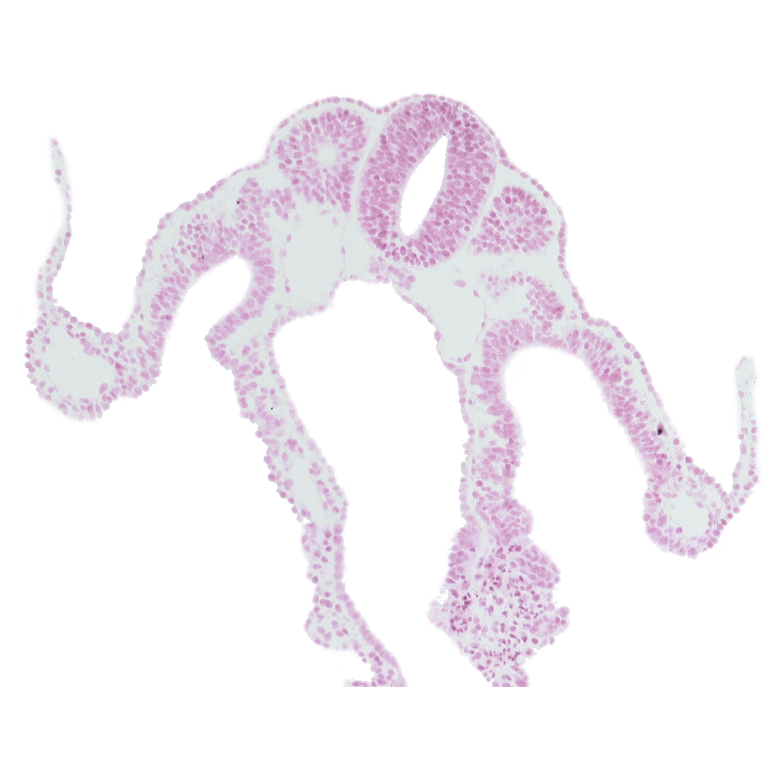 amnion attachment, amniotic cavity, caudal part of dermatomyotome 8 (C-4), dorsal aorta, extra-embryonic coelom, intermediate mesenchyme, lateral body fold