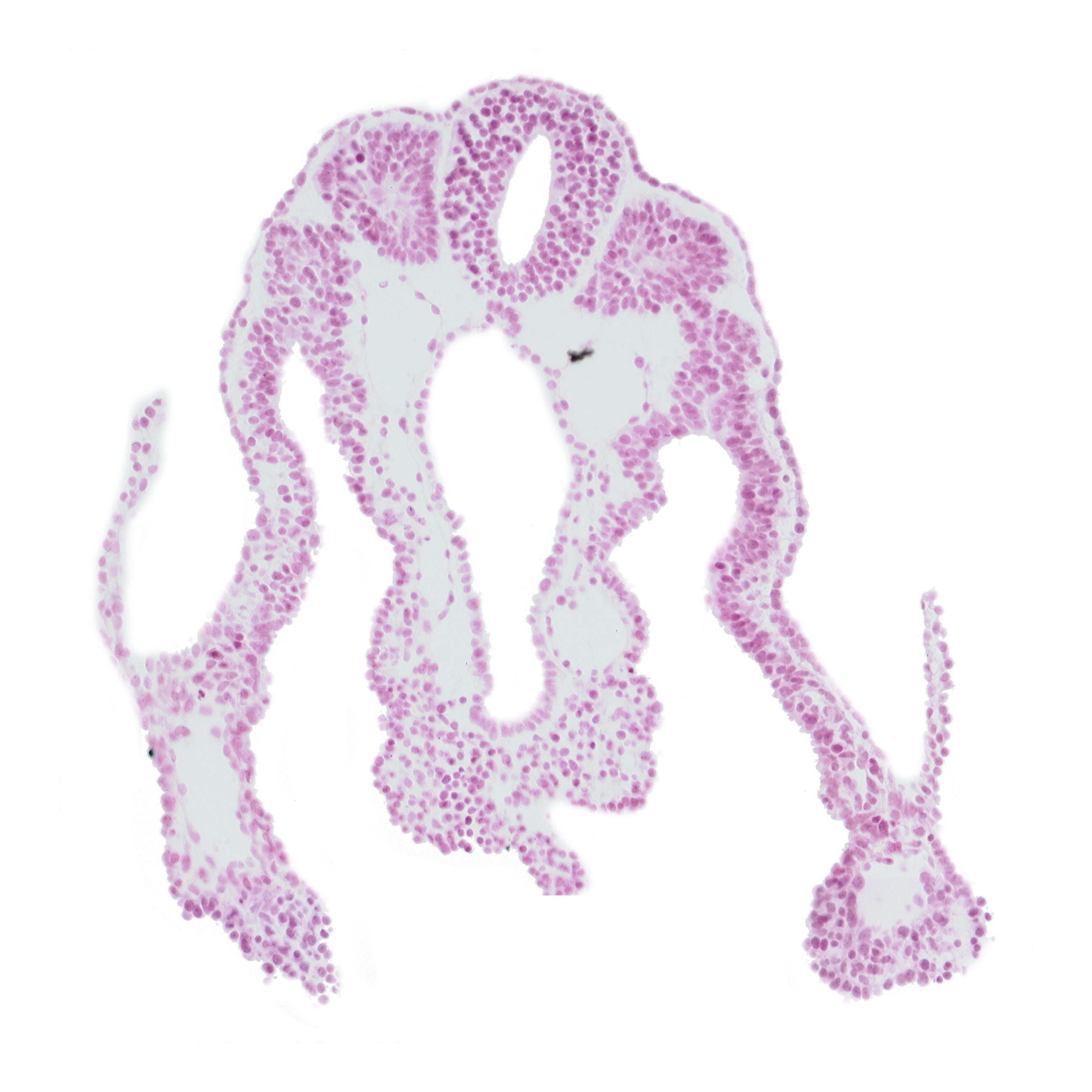 caudal part of umbilical vesicle cavity, communication between peritoneal cavity and extra-embryonic coelom, dorsal aorta, intermediate mesenchyme, left umbilical vein, neural tube, right umbilical vein, somite 11 (C-7), vitelline (omphalomesenteric) vein