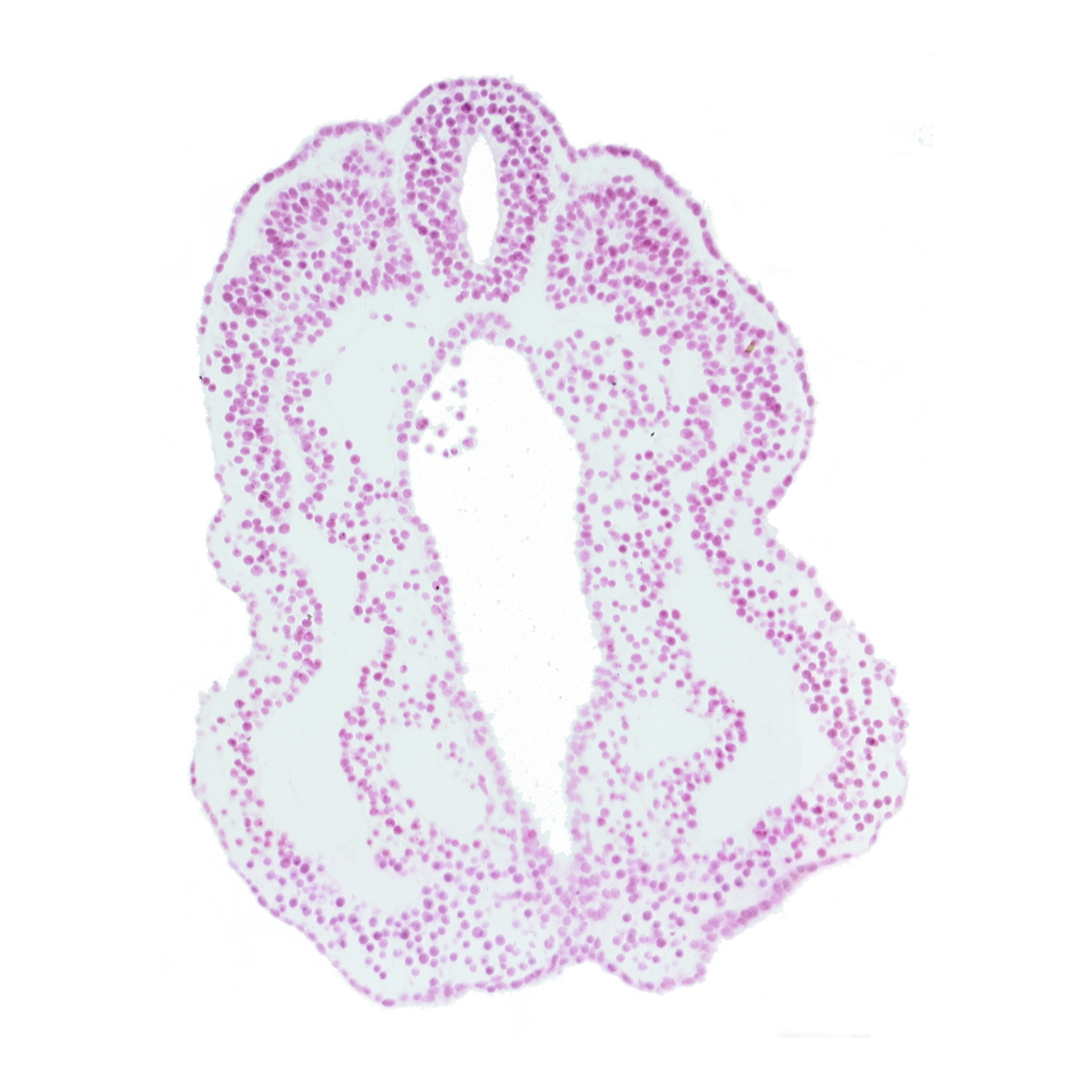 endoderm, hindgut, intermediate mesenchyme, neural tube, paraxial mesoderm, peritoneal cavity (coelom), somatopleuric mesoderm, splanchnopleuric mesoderm, surface ectoderm