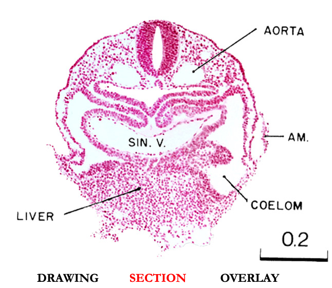 Slice B section