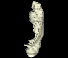 Embryo