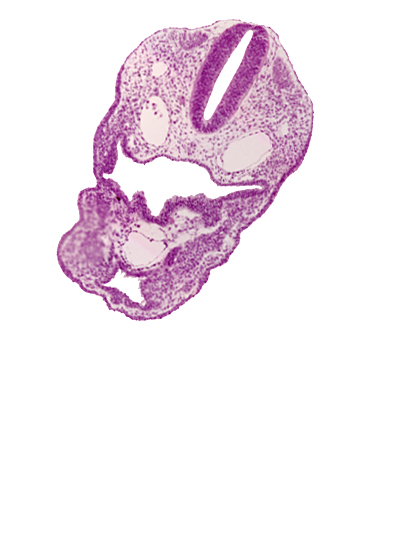 aortic sac, cephalic part of pericardial cavity, dermatomyotome 2 (O-2) , dorsal aorta, edge of aortic arch 3, pharyngeal groove 1, pharyngeal groove 2, pharyngeal groove 3, pharynx, precardinal vein