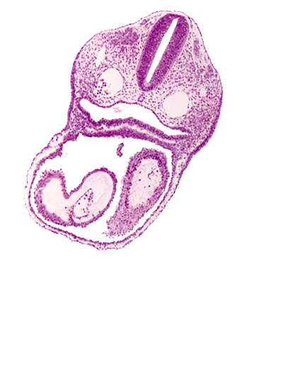 cephalic edge of dermatomyotome 3 (O-3), cephalic edge of right atrium, conus cordis, dorsal aorta, endocardium, epimyocardium, left atrium, notochord, pharyngeal pouch 4, truncus arteriosus