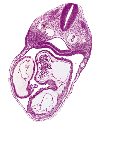 cardiac jelly, caudal part of dermatomyotome 3 (O-3), dorsal aorta, endocardium, epimyocardium, interatrial foramen (primum), left atrium, left ventricle, pharynx, precardinal vein, right atrium, right ventricle, ultimopharyngeal pouch