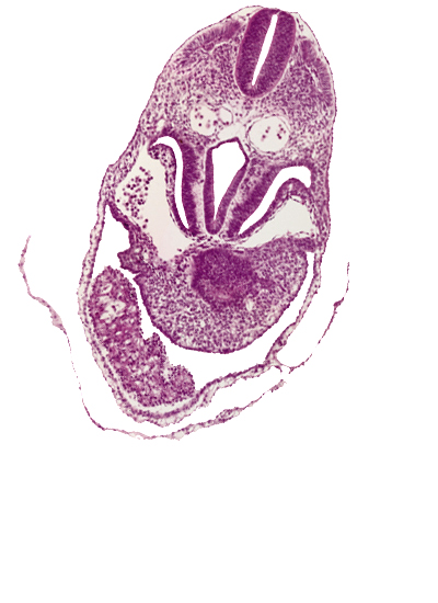 amnion, caudal edge of respiratory primordium, caudal part of ventricles, cephalic wall of hepatic antrum, dermatomyotome 5 (C-1), foregut, junction of right horn of sinus venosus and right postcardinal vein, pericardial cavity, pericardioperitoneal canal (pleural cavity), postcardinal vein, right horn of sinus venosus, sclerotome, septum transversum, ventral body wall