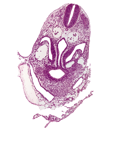 amnion, amnion attachment, amniotic cavity, caudal part of pericardioperitoneal canal (pleural cavity), dermatomyotome 6 (C-2), extra-embryonic coelom, hepatic antrum, hepatic diverticulum, junction of amnion and umbilical vesicle, junction of left horn of sinus venosus and left umbilical vein, pericardial cavity, postcardinal vein, sclerotome, ventral body wall