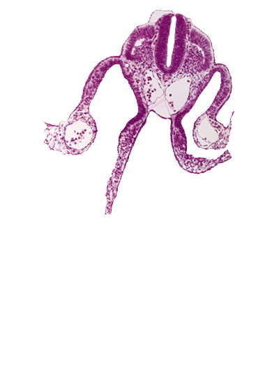 amnion attachment, cephalic extent of mesonephric vesicles, dermatomyotome 9 (C-5), left umbilical vein, midgut, perinotochordal lamina, peritoneal cavity, right umbilical vein, sclerotome, umbilical vesicle cavity