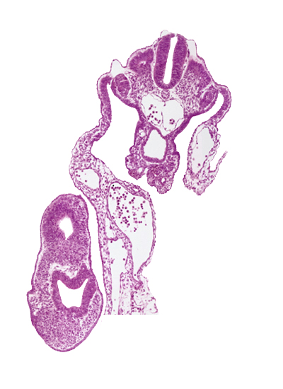 amnion attachment, caudal edge of peritoneal cavity, caudal eminence, caudal part of upper limb bud, cephalic edge of dermatomyotome 13 (T-1), cloacal membrane, gastrulation (primitive) streak, mesonephric vesicle(s), neural plate