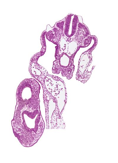 amnion, amnion attachment, caudal eminence, caudal part of peritoneal cavity, cloaca, cloacal membrane, common umbilical artery, dermatomyotome 13 (T-1), gastrulation (primitive) streak, hindgut, left umbilical vein, mesonephric vesicle(s), neural plate, right umbilical vein