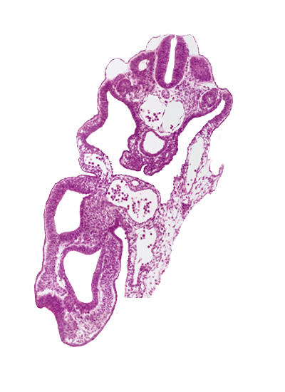 allantois, caudal part of notochord, cloaca, common umbilical artery, dermatomyotome 13 (T-1), hindgut, left umbilical vein, perinotochordal lamina, peritoneal cavity, primordial genital ridge, somatopleuric mesoderm, splanchnopleuric mesoderm
