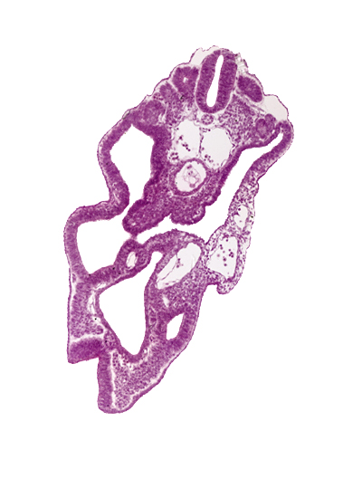 aortic bifurcation, caudal edge of dermatomyotome 14 (T-2), cloaca, hindgut, left umbilical artery, left umbilical vein, mesonephric duct, right umbilical artery