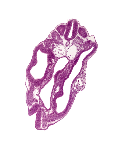 caudal neuropore, cephalic edge of dermatomyotome 16 (T-4), dermatomyotome 15 (T-3), dermatomyotome 15-16 intersegmental region, endoderm, junction of cloaca and hindgut, left common iliac artery, neural tube, notochord, peritoneal cavity, right common iliac artery, somatopleuric mesoderm, splanchnopleuric mesoderm, surface ectoderm, tributary of left umbilical vein